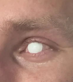 Crazy-linssit Blind White