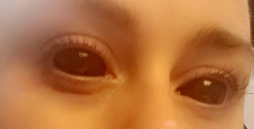 Sclera-linssit Sabretooth